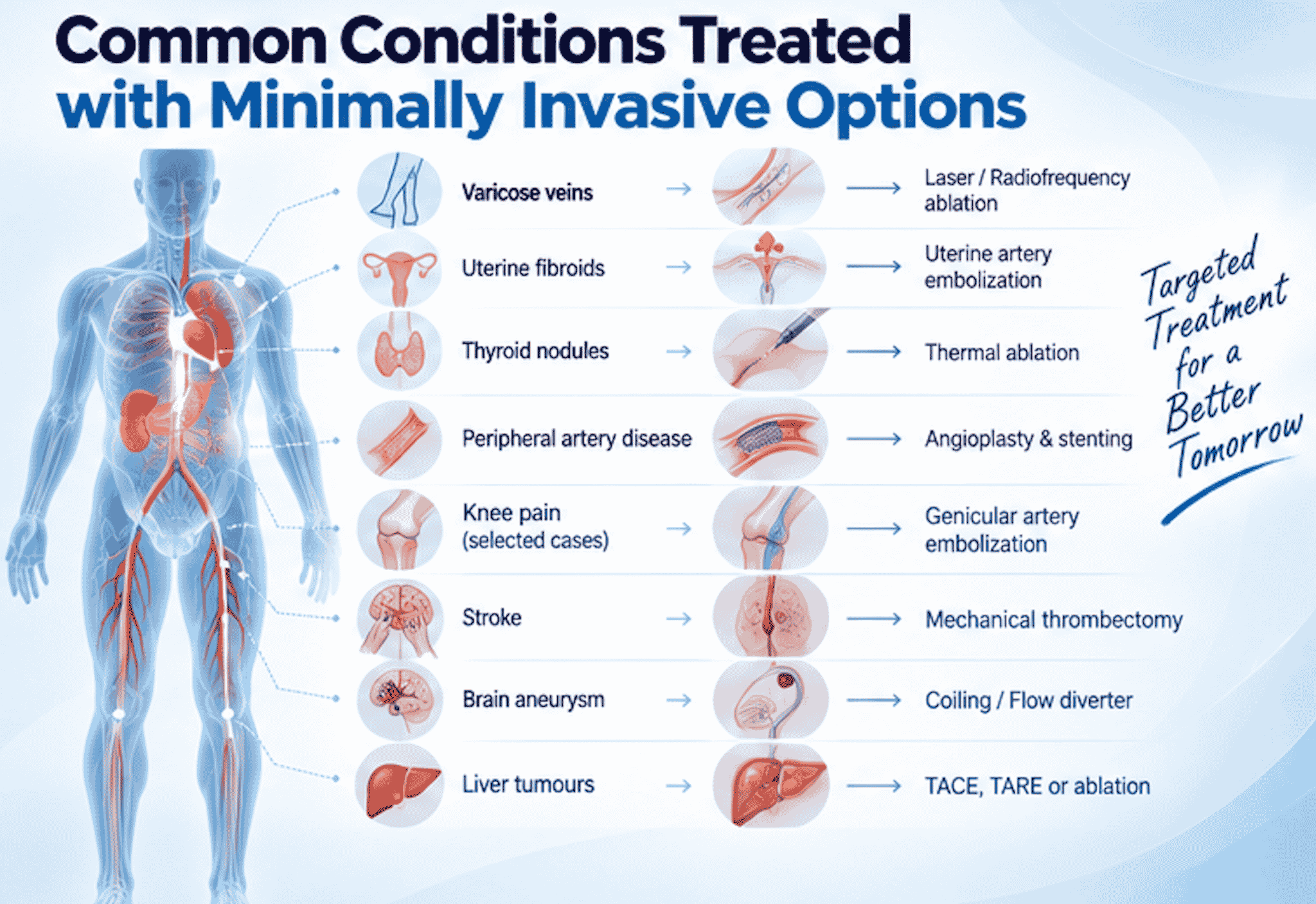 Illustration of conditions treated by Interventional Radiology including varicose veins, uterine fibroids, thyroid nodules, peripheral artery disease, knee pain, stroke, brain aneurysm, and liver tumours using minimally invasive image-guided procedures.